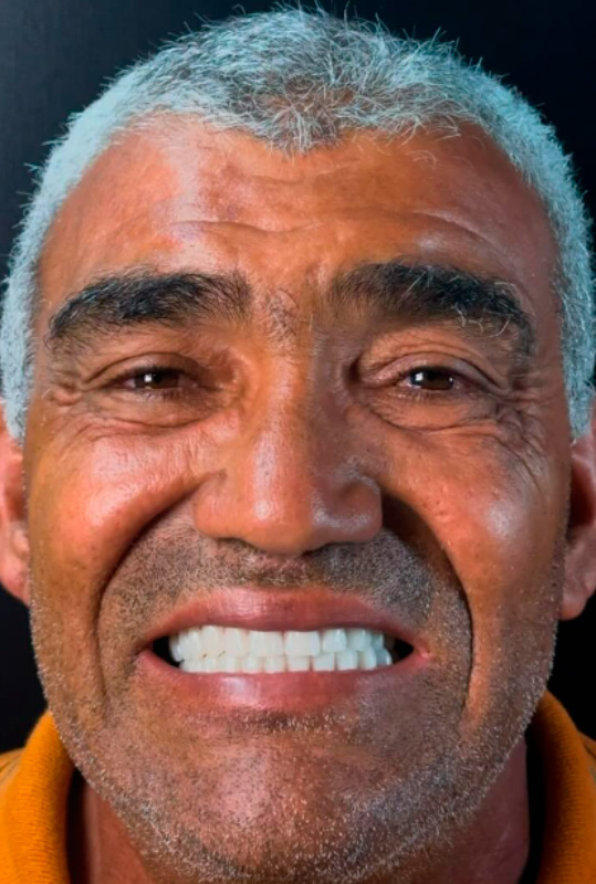 Resultado depois do procedimento odontológico